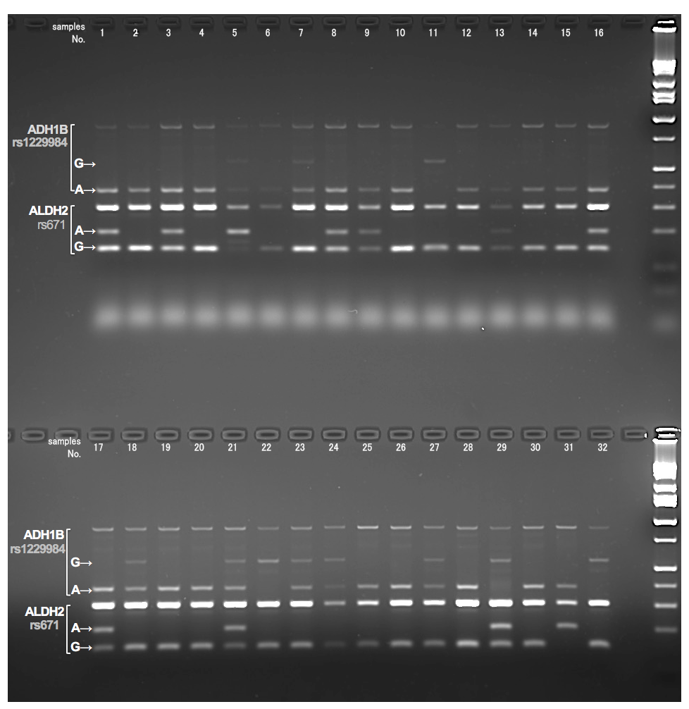 ADH1BALDH2̂QSNPPCR